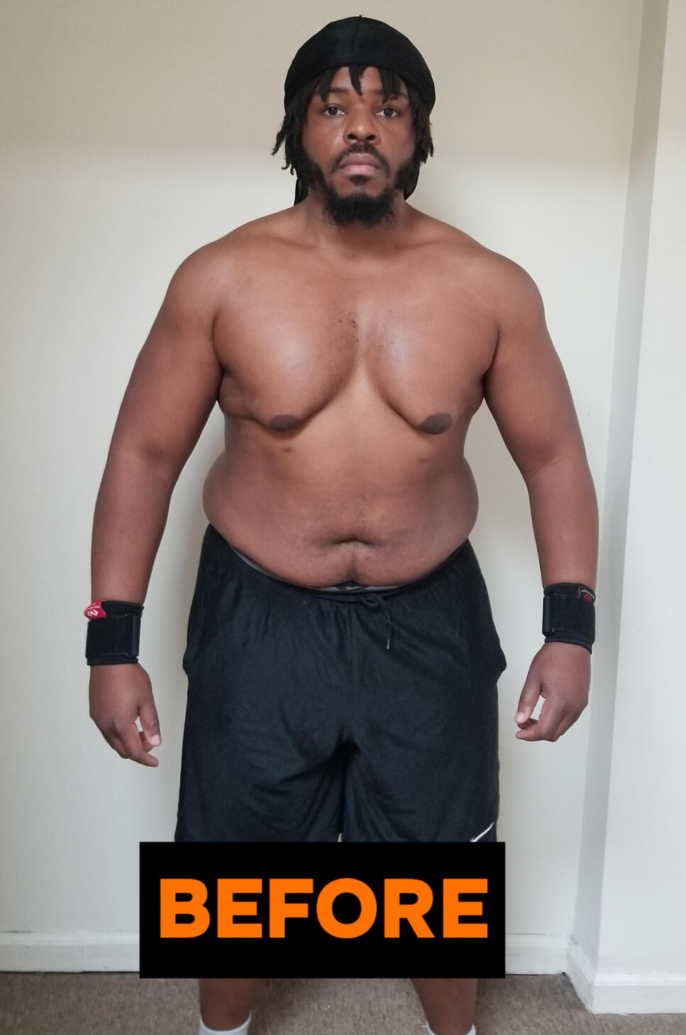 Marc A before transformation